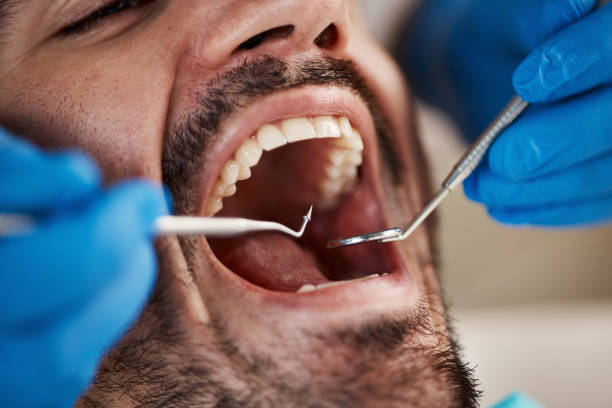 Best Same-Day Emergency Dental Services in Town Creek, AL