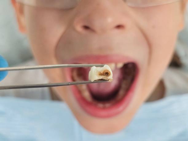 Best Emergency Root Canal Treatment in Town Creek, AL
